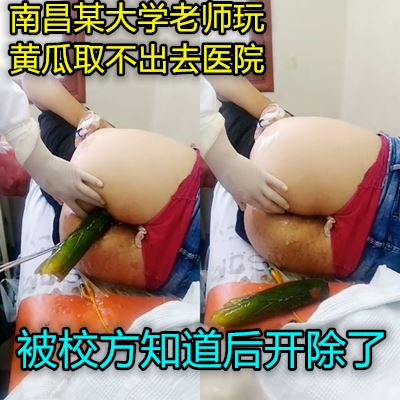 真實南昌一騷女往肛門塞黃瓜無法拔出被送到醫院取出